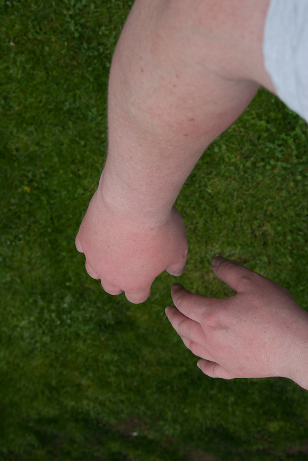 260414Bienenstiche-durch-Handschuhe002.jpg