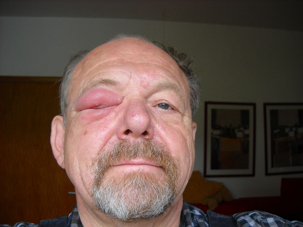 k-Das Auge.jpg